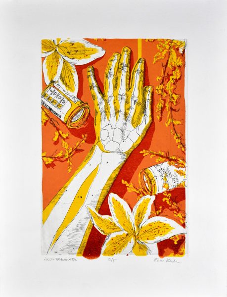 An intaglio showing a skeleton hand titled "Post-Traumatic."