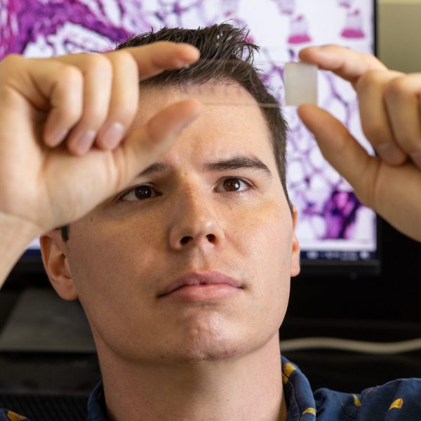 Lab Manager Ron Allen looks at microscope slide in Imaging and Histology Core Facility lab.