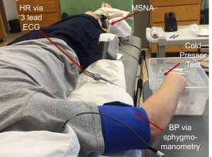 Cold pressor test being preformed on an individual.